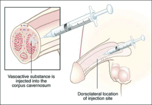 will penis enlargement ever be possible