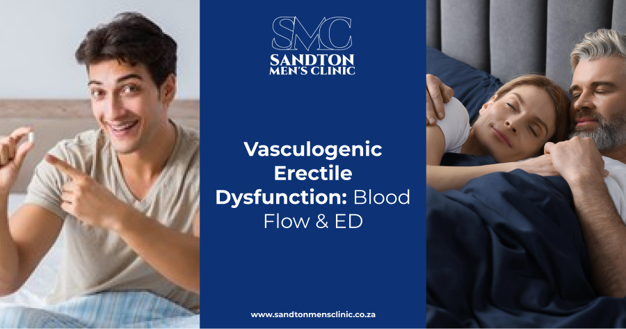 vasculogenic erectile dysfunction